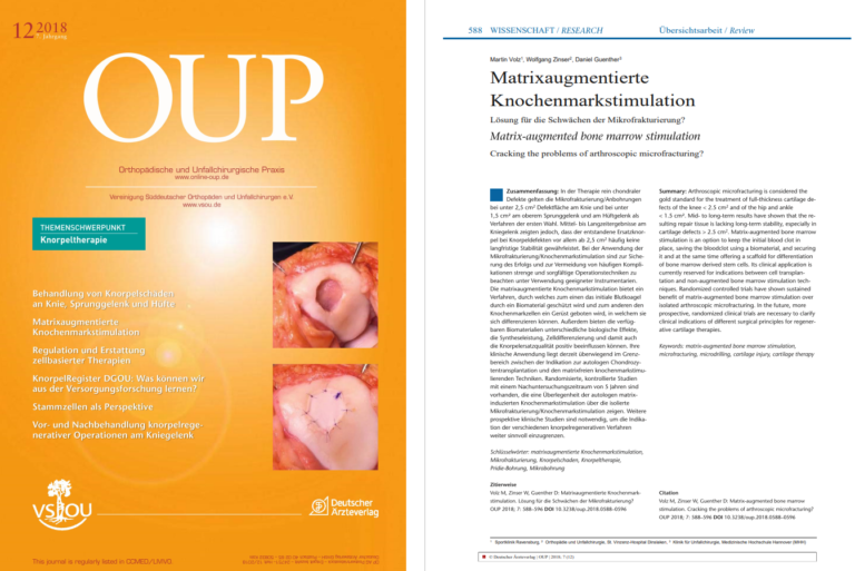 Matrix-augmented bone marrow stimulation (MABMS) | Medtextpert